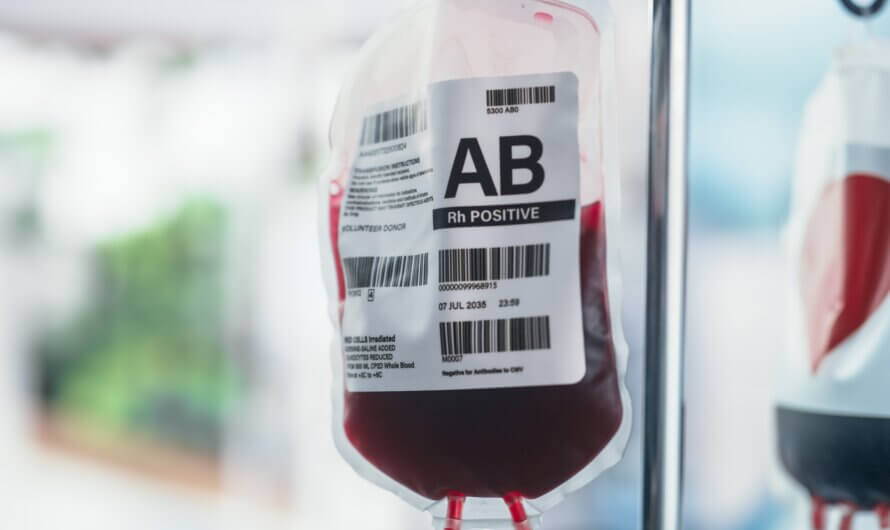 Bêta-thalassémie : l&rsquo;incroyable exploit de chercheurs chinois qui libère les patients des transfusions
